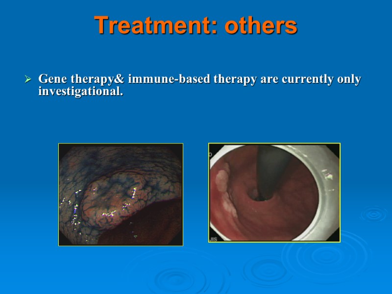 Treatment: others  Gene therapy& immune-based therapy are currently only investigational.